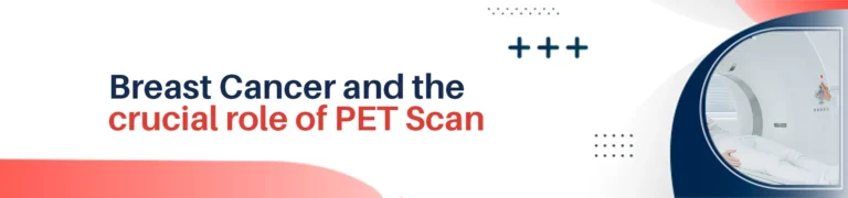 Don’t Be Afraid to Get Checked: Why Early Detection with PET Scans Matters For Breast Cancer